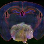 uncovering-craniopharyngioma’s-growth-mechanism-may-identify-new-therapy