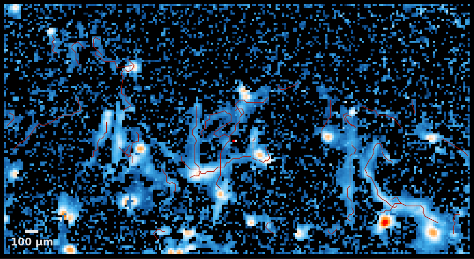 ai-expedites-motor-neuron-analysis-and-screening-in-als-research