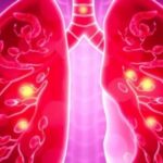 new-lung-cancer-test-outperforms-traditional-methods-in-predicting-early-stage-survival
