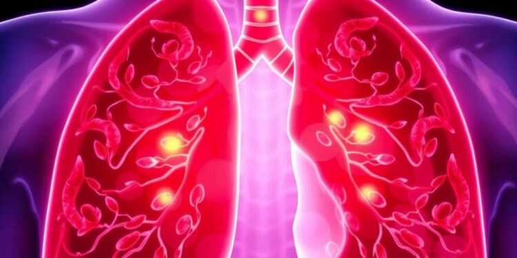 new-lung-cancer-test-outperforms-traditional-methods-in-predicting-early-stage-survival