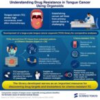 oral-cancer-organoids-uncover-insights-into-chemotherapy-resistance