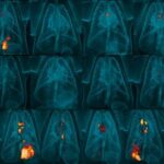 revolutionary-self-destructing-vaccine-shows-improved-tuberculosis-protection-in-monkeys