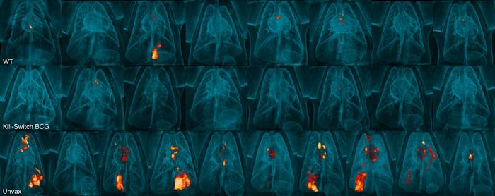 revolutionary-self-destructing-vaccine-shows-improved-tuberculosis-protection-in-monkeys