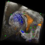 new-software-tool-unveils-insights-within-complex-3d-biomedical-images
