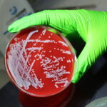 genetic-analysis-reveals-bacterium’s-survival-tactics