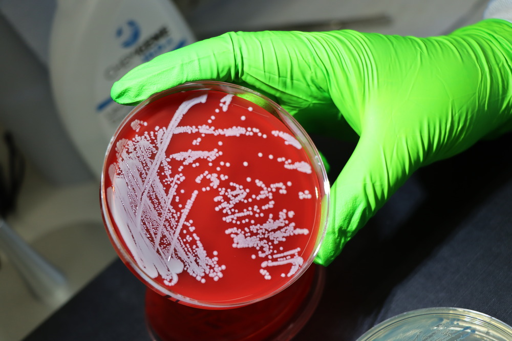 genetic-analysis-reveals-bacterium’s-survival-tactics