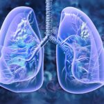 os-therapies’-her2-drug-prevented-lung-cancer-from-returning-in-a-3rd-of-patients