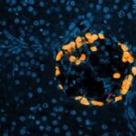 mass-migration-of-immune-cells-found-to-regulate-blood-glucose-levels
