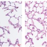 new-findings-reveal-mechanism-by-which-cigarette-smoke-harms-essential-lung-immune-cells