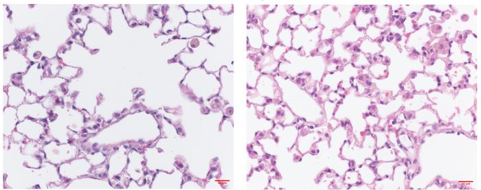 new-findings-reveal-mechanism-by-which-cigarette-smoke-harms-essential-lung-immune-cells