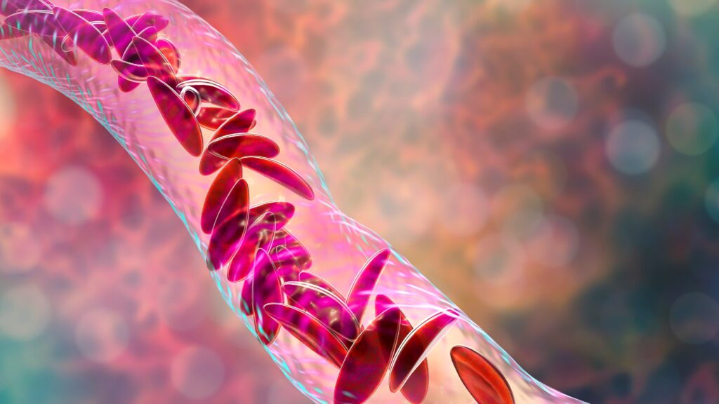 novo-nordisk-gets-bach1,-inking-immvention-deal-to-orchestrate-attack-on-sickle-cell-disease