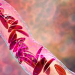 novo-nordisk-gets-bach1,-inking-immvention-deal-to-orchestrate-attack-on-sickle-cell-disease