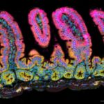 t-cells-mobilize-to-combat-gut-infections