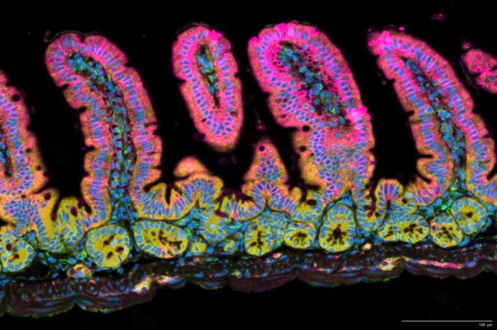 t-cells-mobilize-to-combat-gut-infections
