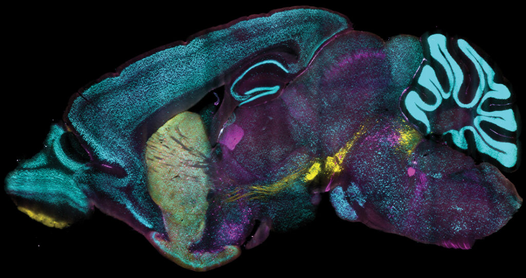 curve-brings-speed-and-precision-to-organ-scale-protein-mapping