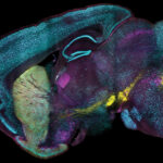 curve-brings-speed-and-precision-to-organ-scale-protein-mapping