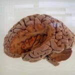 mapping-the-brain’s-remarkable-self-healing-mechanisms-following-stroke