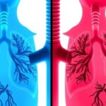 sex-based-differences-in-lung-cancer
