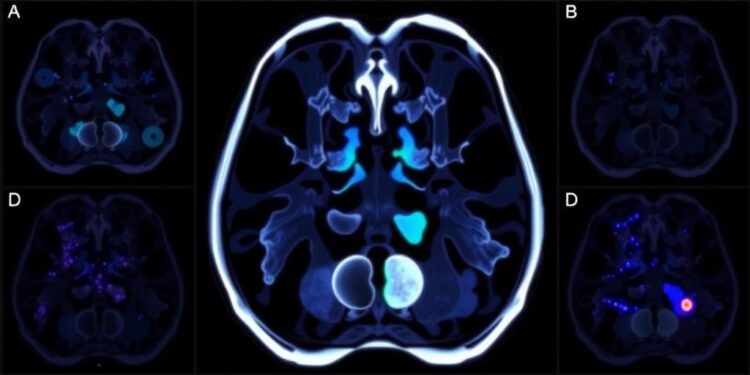 jnm-releases-new-standardized-guidelines-for-fibroblast-activation-protein-pet-procedures