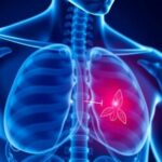 genetic-variant-linked-to-increased-prostate-cancer-risk-in-families