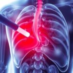 new-urine-test-identifies-aggressive-prostate-cancer