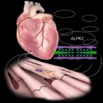 emerging-therapeutic-target-identified-for-fatal-heart-failure:-alpk2