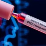 blood-test-could-identify-stroke-type-prior-to-hospital-arrival,-enabling-swift-treatment