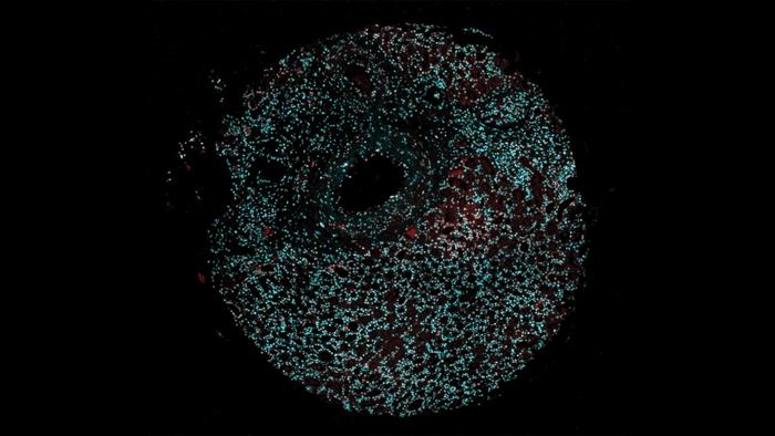 a-glimmer-of-hope-for-cancer-patients