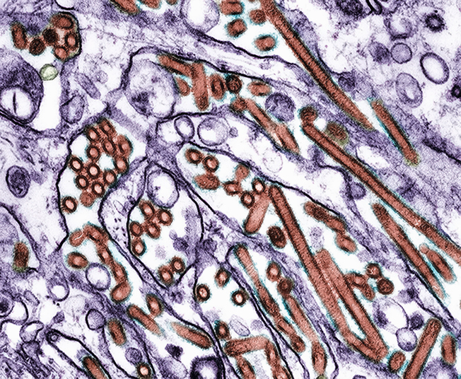 t-cells-in-people-already-offer-some-protection-against-bird-flu