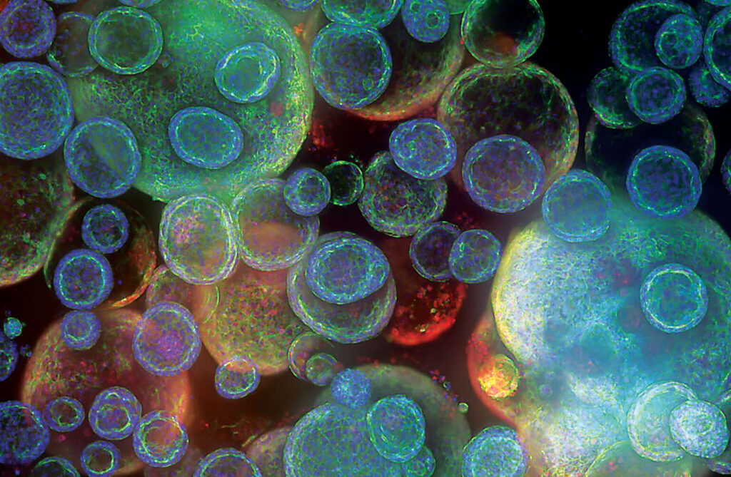 2025-trends:-organoids