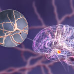 ketamine-reduces-l-dopa-related-uncontrolled-movements-in-parkinson’s-rat-model