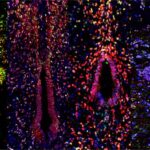 exploring-the-regenerative-mechanisms-behind-spinal-cord-injury-repair