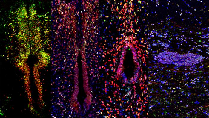 exploring-the-regenerative-mechanisms-behind-spinal-cord-injury-repair