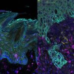 scientific-breakthrough:-the-transformation-of-healthy-stem-cells-into-oral-cancer