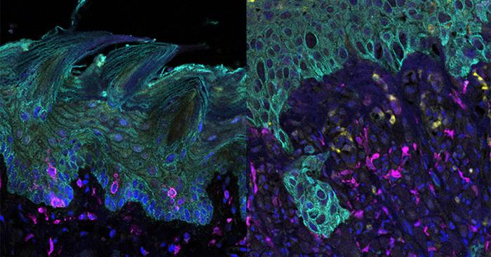 scientific-breakthrough:-the-transformation-of-healthy-stem-cells-into-oral-cancer