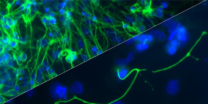exploring-the-mechanisms-behind-the-poised-state-of-developmental-genes