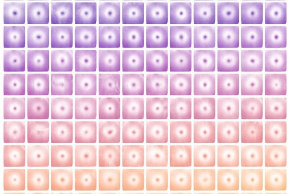 multi-omic-spatial-maps-use-retinal-thickness-to-detect-systemic-disease