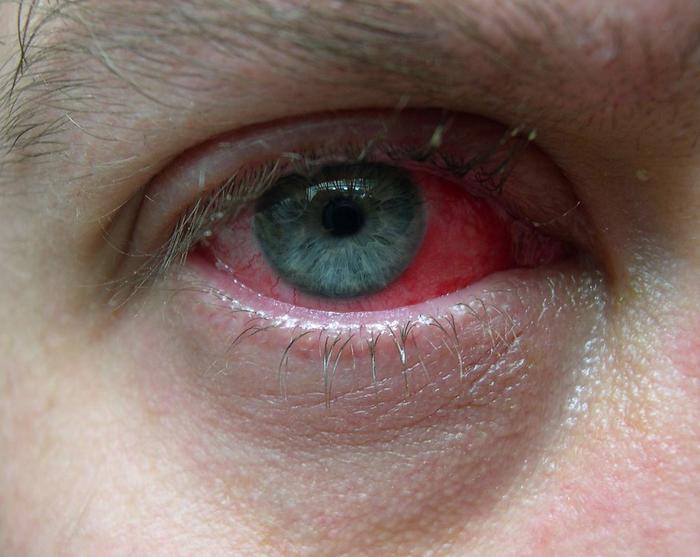 revolutionary-stem-cell-injections:-a-safer-approach-to-treating-inflammatory-eye-diseases
