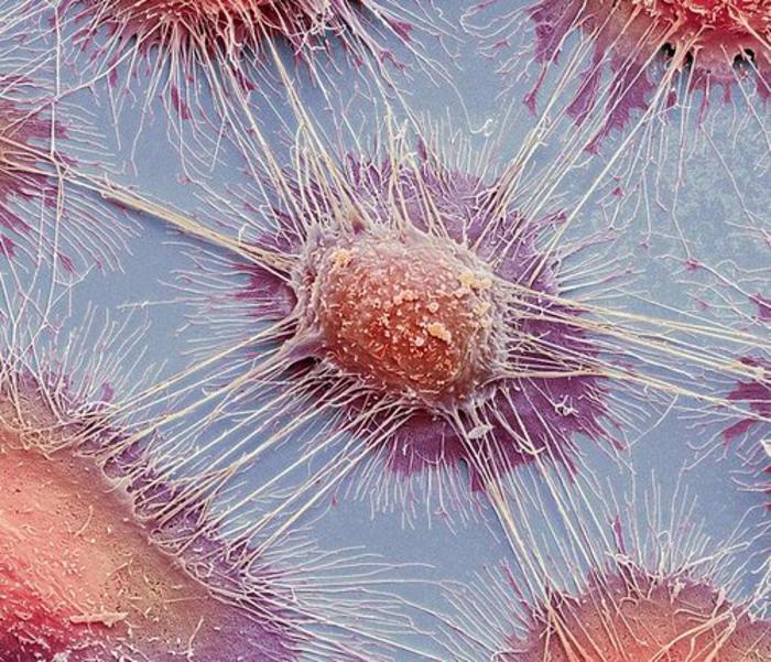 how-cancer-cells-manipulate-the-immune-system-by-modifying-mitochondrial-function