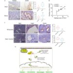 essential-role-of-pak5-in-phosphorylating-pkm2-for-anaerobic-glycolysis-in-endometriosis