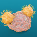 tg-therapeutics-licenses-maxcyte-tech-to-develop-cell-therapies-for-autoimmune-disease