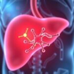 guardian-molecule:-a-new-target-for-advancing-liver-cancer-treatments