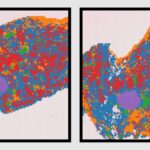 shared-breast-cancer-and-aging-signatures-revealed-by-single-cell-mammary-tissue-atlas