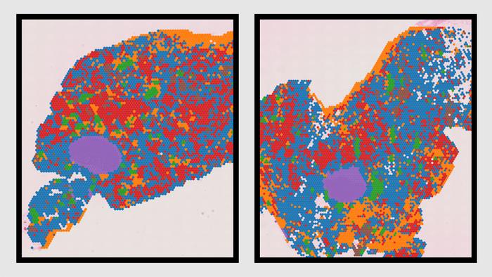 shared-breast-cancer-and-aging-signatures-revealed-by-single-cell-mammary-tissue-atlas