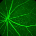 breakthrough-study-reveals-genetic-links-to-retinal-aging-and-brain-health