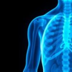 fda-grants-approval-for-vimseltinib-in-treatment-of-tenosynovial-giant-cell-tumor-(tgct)