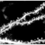promising-molecular-approach-emerges-for-treating-fragile-x-syndrome