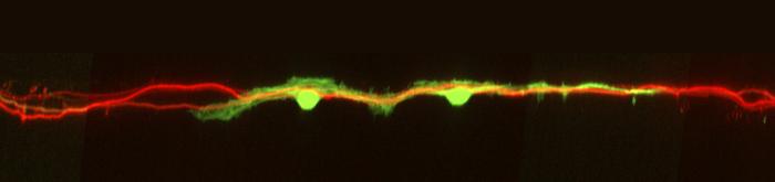 hdac8-inhibition-boosts-neuronal-regeneration-and-enhances-sensory-function-recovery