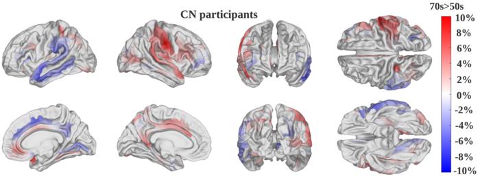 revolutionary-ai-model-reveals-insights-into-the-rate-of-brain-aging