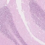 new-research-sheds-light-on-the-complexities-of-cancer-predisposition